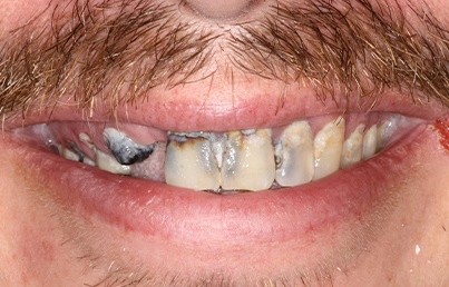 Smile gallary image - Before
